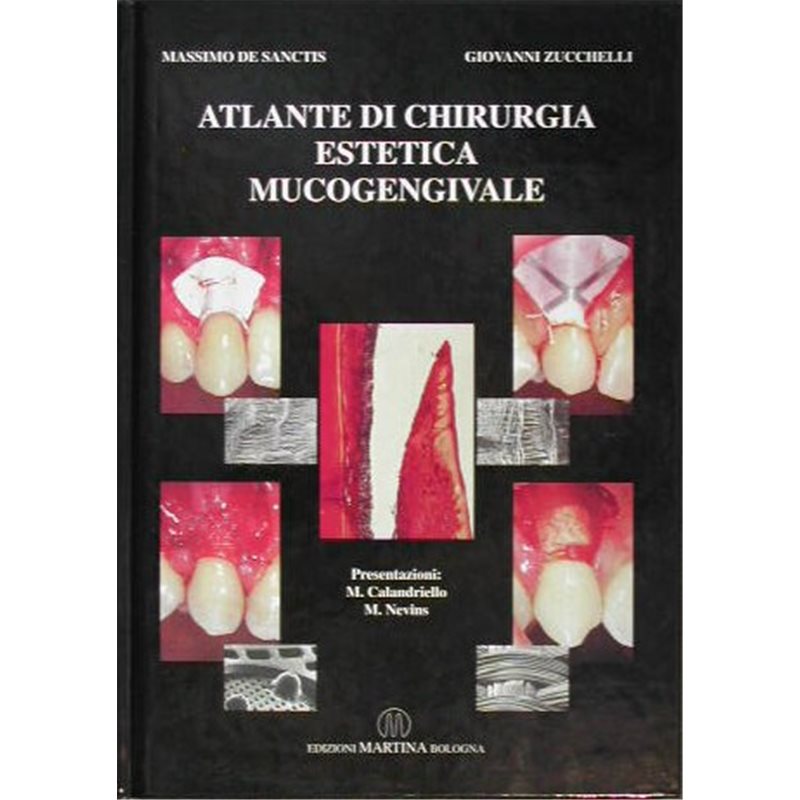 Atlante di chirurgia estetica mucogengivale - 2a Ed.